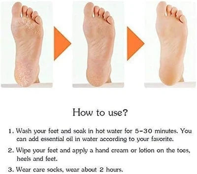 Full Silicone Gel Socks – Moisturizing Heel & Foot Protector Socks